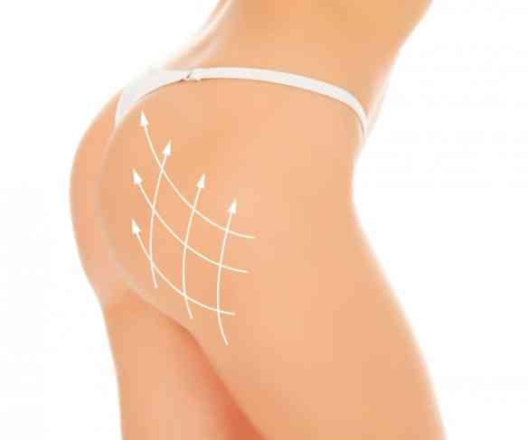 buttock_5