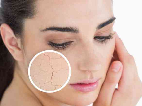 dry-skin-2