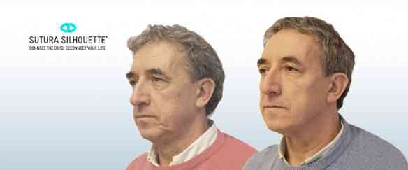 rodrigo-fuzaro-cirurgia-plastica-sutura-silhouete